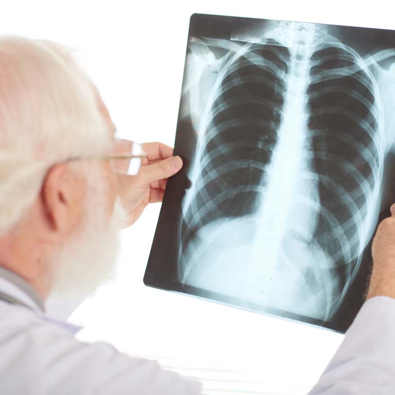 XRAY Medical imaging Ingleburn