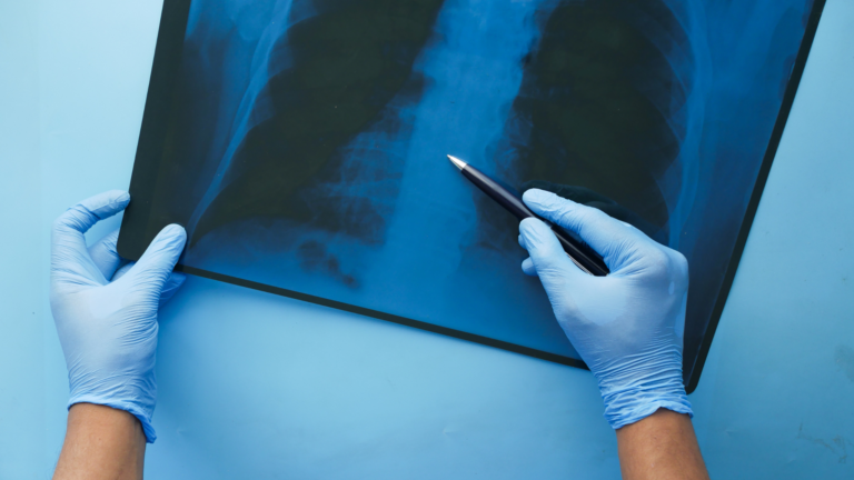 A Comprehensive Guide to X-rays and How They Work