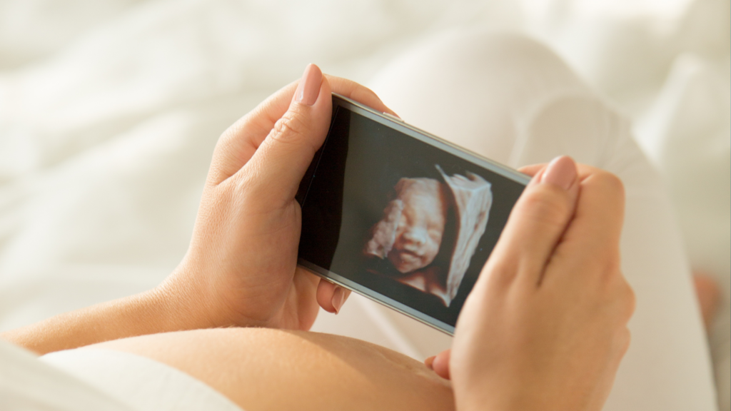 Advantages of 3D and 4D Ultrasound in Pregnancy