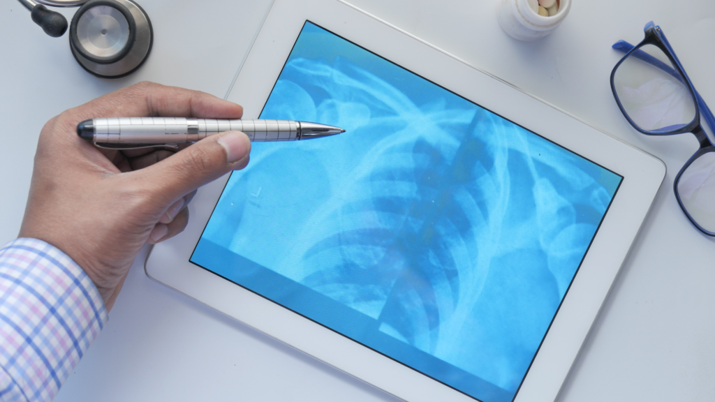Radiation exposure in medical imaging