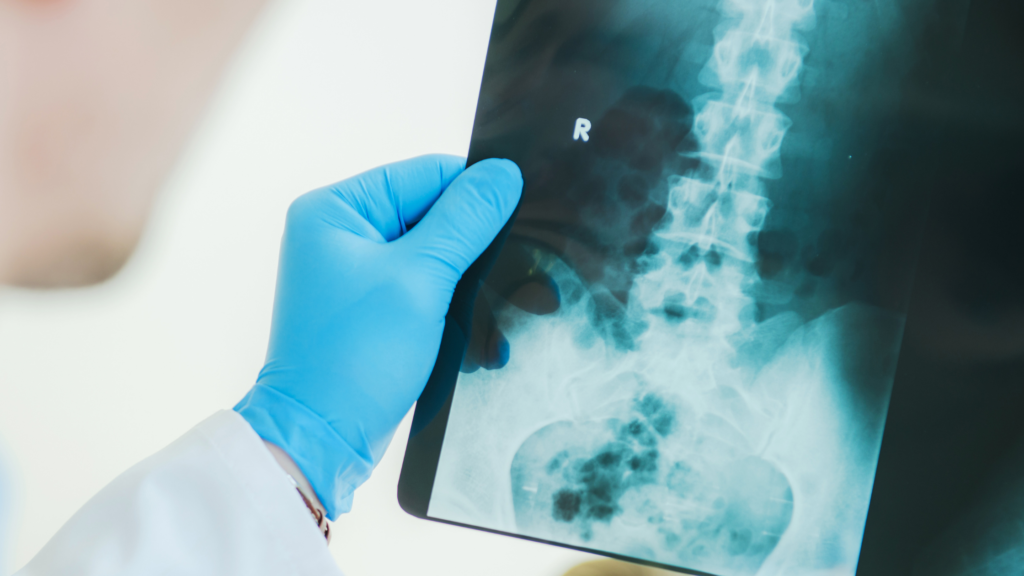 The role of X rays in diagnostic imaging